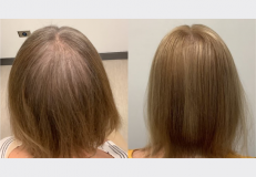 Website Before & After - 3