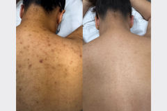 Website Before & After - 2