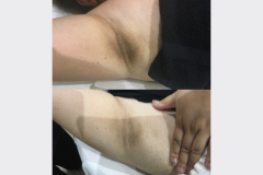 Website Before & After - 1