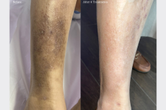 Website Before & After - 1