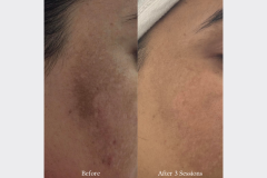 Website Before & After - 1
