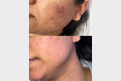 Website Before & After - 1