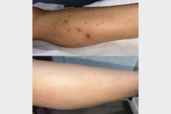 Website Before & After - 1