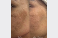 Website Before & After - 2