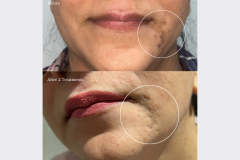 Website Before & After - 1