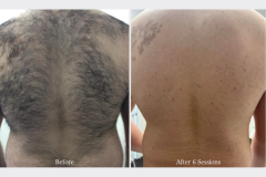 Website Before & After - 2