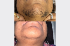 Website Before & After - 2