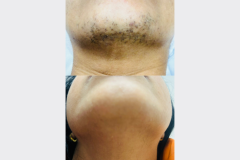 Website Before & After - 1