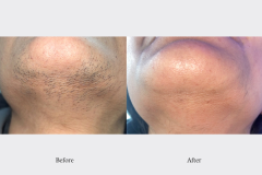 Website Before & After - 1