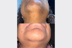 Website Before & After - 3