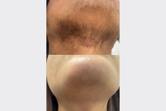 Website Before & After - 1