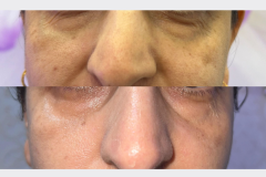 Website Before & After - 1