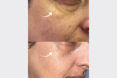 Website Before & After - 2