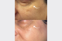 Website Before & After - 3