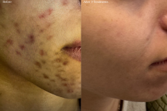 Website Before & After - 1