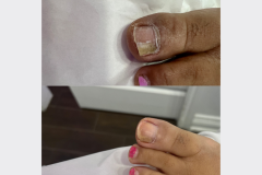 Website Before & After - 2