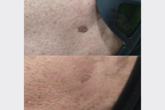 Website Before & After - 1