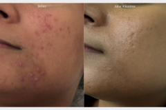 Website Before & After - 1