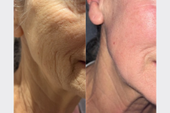 Website Before & After - 1