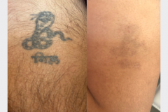 Website Before & After - 2
