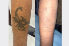 Website Before & After - 2