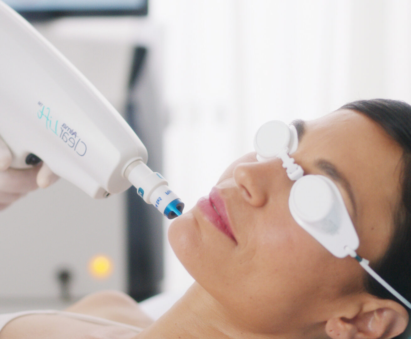 HydraFacial oily skin appearance result